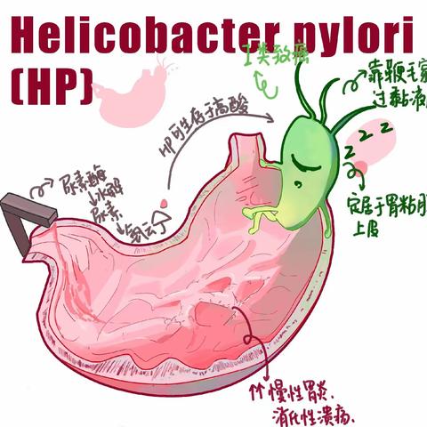 【医疗科普】 幽门螺杆菌感染