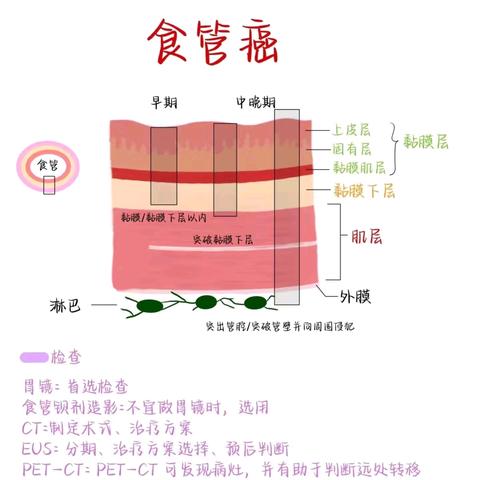 科普｜有关“吃出来的癌症”——食管癌，你了解多少?