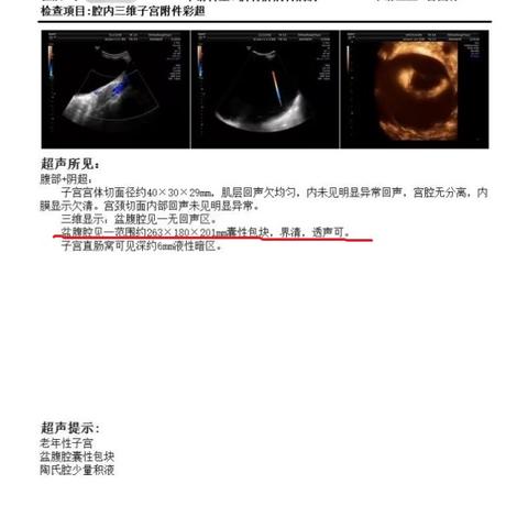 巨大腹部肿物：十堰市中医医院妇产科巧手摘除七旬老人腹内26cm肿瘤