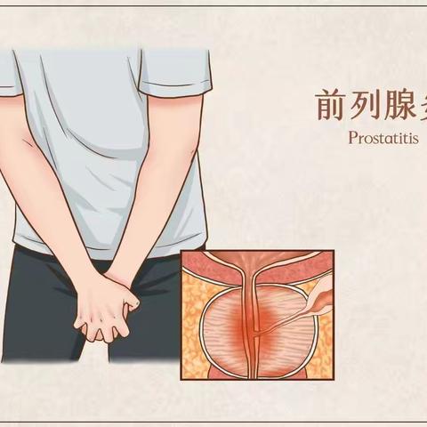 预防前列腺增生，远离“男”言之隐