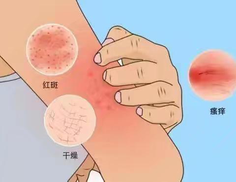 春季常见皮肤病预防及治疗
