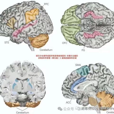 脑科学“神经调控+神经反馈训练”康复模式精准改善自闭症儿童核心障碍