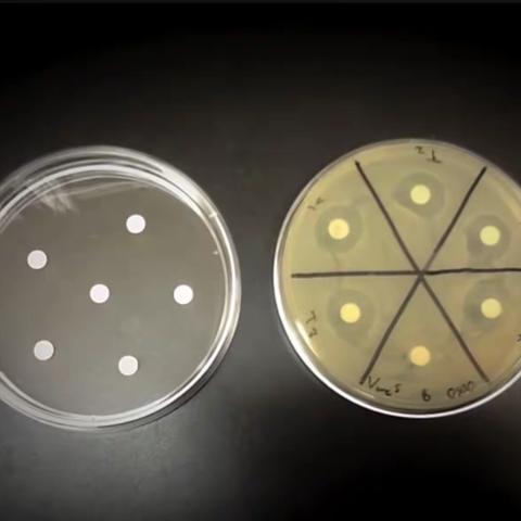 Disk Diffusion Method (Kirby Bauer Method)