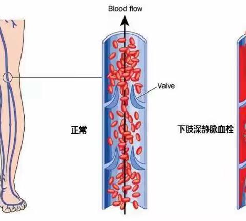 微小导丝血管行，巧妙手法解病痛