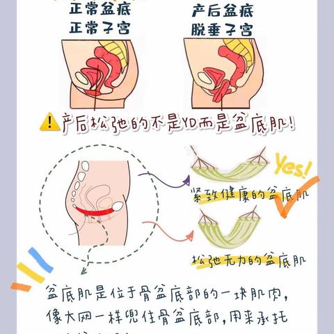 盆底肌修复后漏尿—隐匿性尿失禁