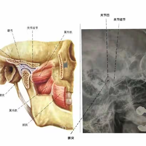 张不开嘴的痛，针灸帮助您