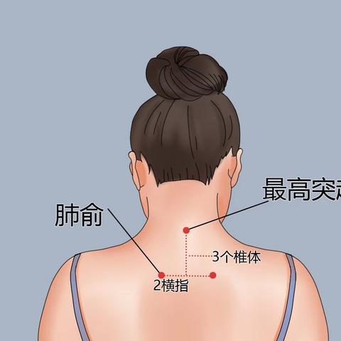 手术准备好了，患者却“跑了”…… 到底发生了什么