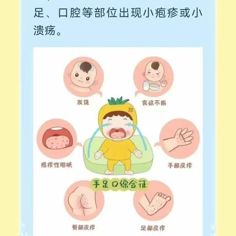 乌孜别克族乡中心幼儿园春季传染病预防知识宣传