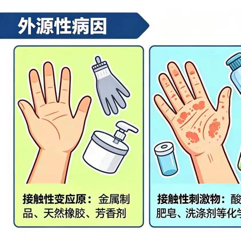 【蓝中医-皮肤科】告别反复手部湿疹：超实用科学防护全攻略