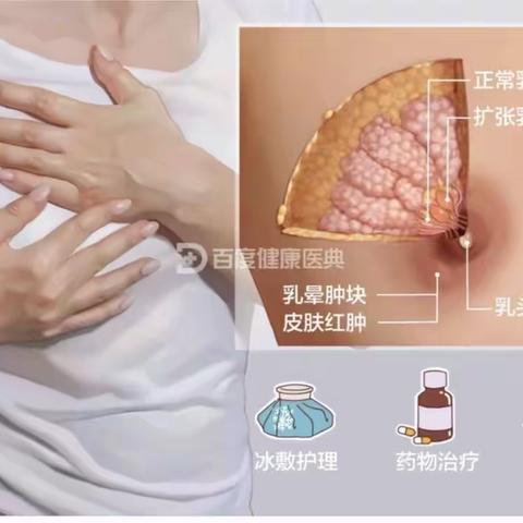 浆细胞性乳腺炎——痛苦又难缠，到底应该怎么治？