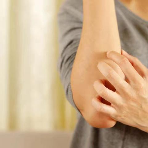 【皮肤健康】皮炎反复发作、类型繁多，你能分清楚吗？
