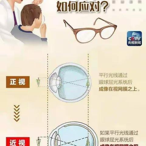 青少年应该如何预防近视？