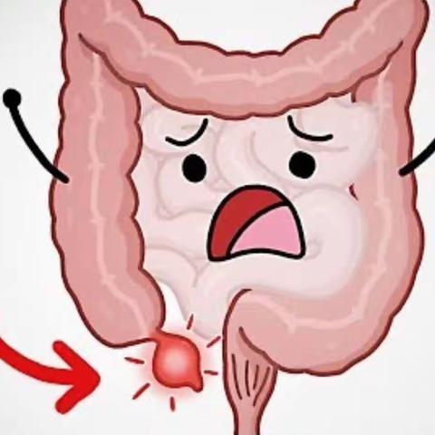 带大家了解一下腹腔镜阑尾切除