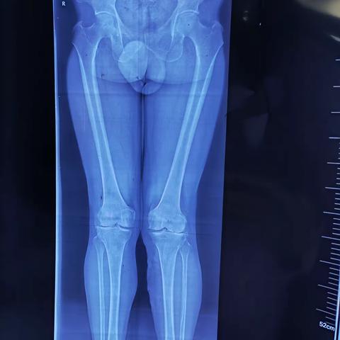 榆阳区人民医院 榆林市儿童医院骨的简篇