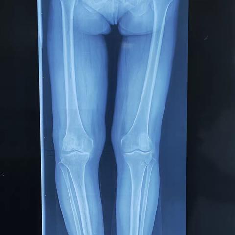 榆林市榆阳区人民医院 关节与运动损伤科 —— 保膝篇（二）