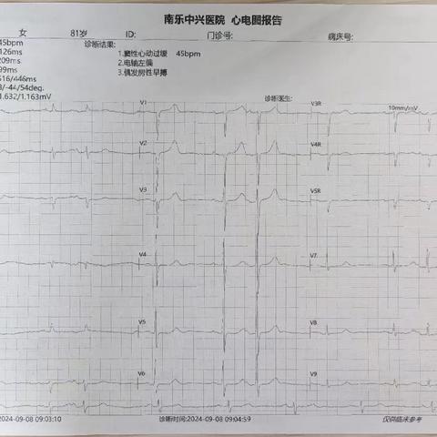 阵发性意识丧失“谁”之过？