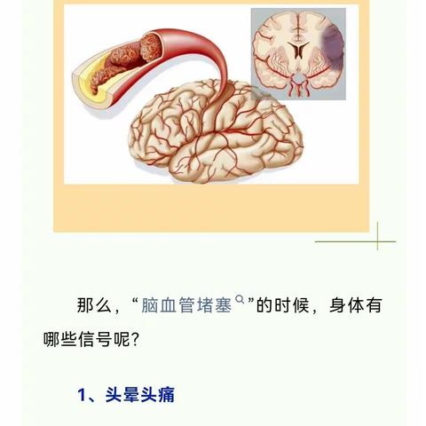 脑血管堵塞怎么知道