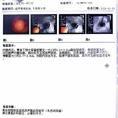 双镜联合