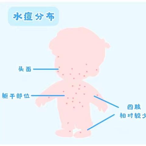 【疾病预防】预防水痘 健康成长——滨河湾水痘预防知识宣传