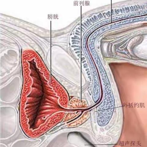 尿道损伤的健康宣教