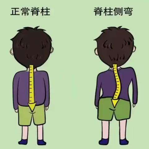 守护健康姿态，远离运动障碍——关注脊柱侧弯与腿型异常