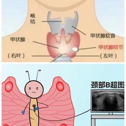 妊娠期甲状腺疾病，您了解吗?