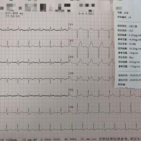 急诊PCI——与时间赛跑，挽救年轻生命