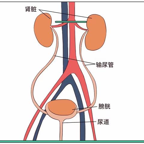 华西魏武然教授指导我院泌尿科成功开展输尿管狭窄球囊扩张手术