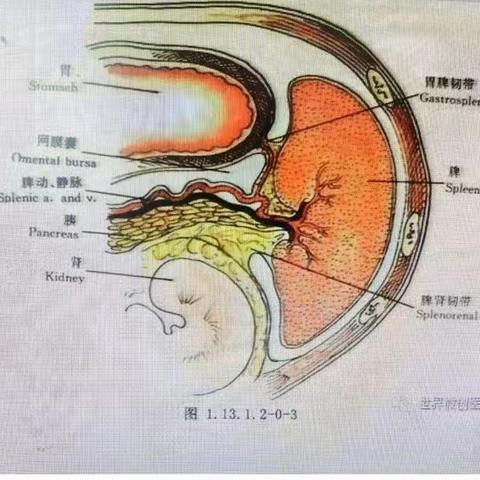 许昌医院普通外科二病区完成我院首例腹腔镜脾脏切除术