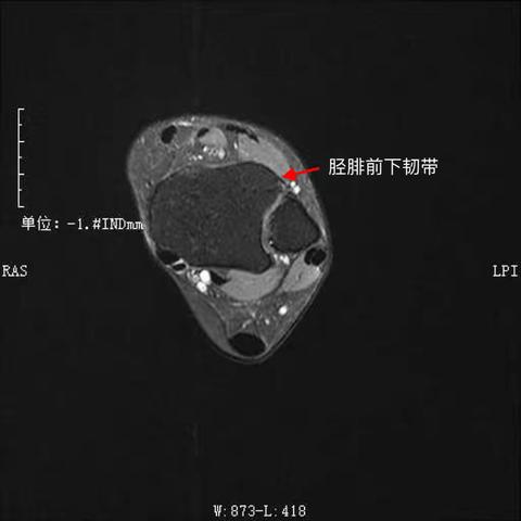 影像解剖学习笔记