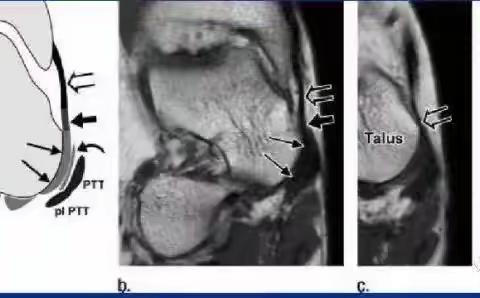 影像解剖学习笔记