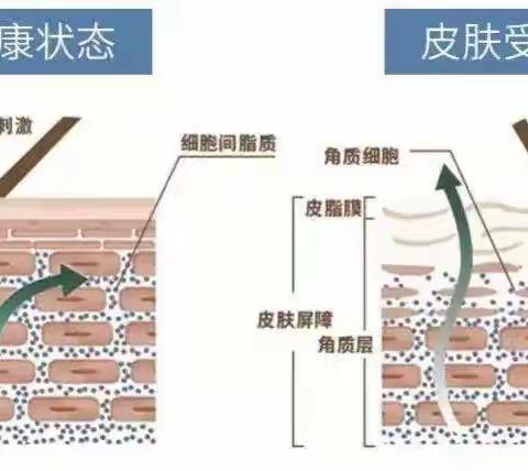 换季皮肤问题多？  你想知道的都在这里！