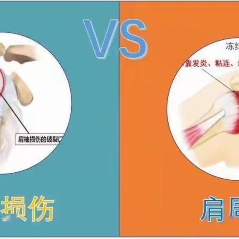 分清 肩袖损伤与 肩周炎~~让您摆脱“肩”难，“肩”强无比！