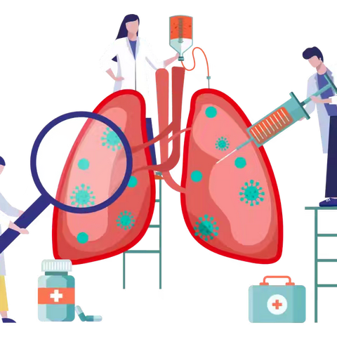 从DeepSeek到AI肺结节筛查软件：革新肺癌早期诊断