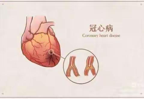 冠心病的宣教