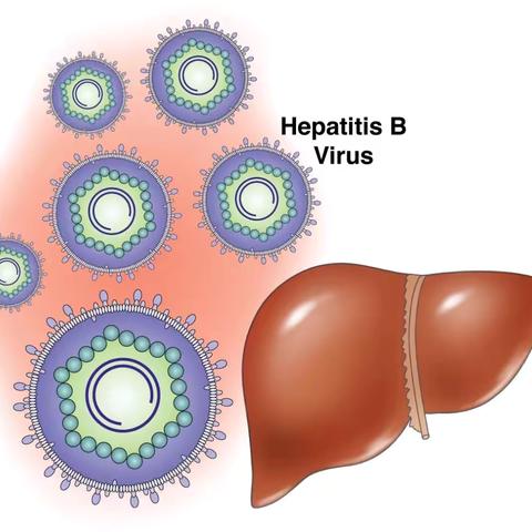 揭开乙肝的的神秘面纱