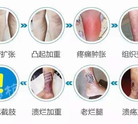 别让“蚯蚓腿”犯了拖延症