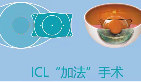 成都ICL晶体植入手术的价值密码：如何让数万元投入近视手术物超所值