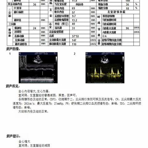 晋城大医院介入科周记----急性下肢动脉栓塞介入治疗一例