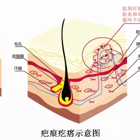 真皮恢复 —— 旷世奇闻