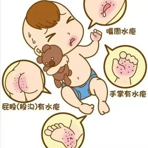 “预防手足口病 守护幼儿健康”--多拉特乡牧业定居学校手足口病预防知识宣传