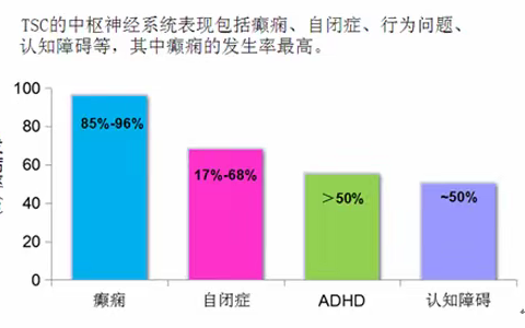 结节性硬化症诊断标准，结节性硬化影像表现