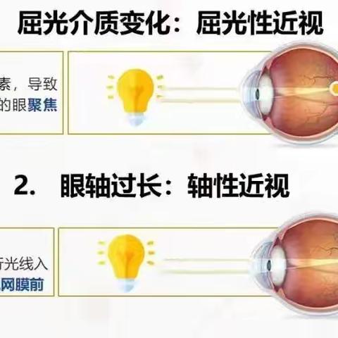 【育幼•保健】爱眼护眼 从小做起——麦积区天启幼儿园近视防控知识宣传