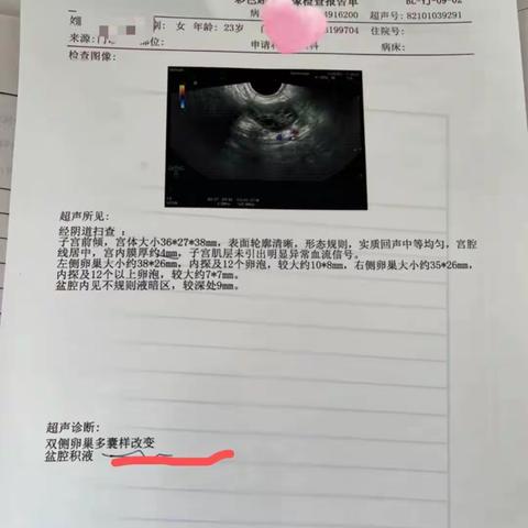 多囊卵巢综合征自然怀了，我是这样调理的~