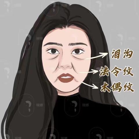 法令纹剥离手术怎么做的