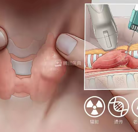 【高尚健康】谈“甲”色变，体检发现甲状腺结节？莫要慌！