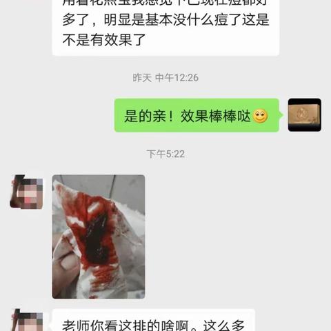 花熙宝排恶露是专业的