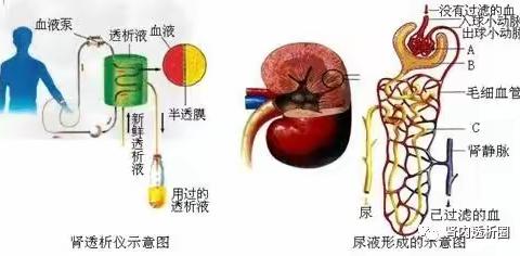 内瘘血栓形成原因及预防处理！