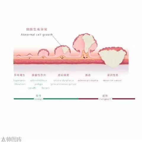 肠息肉镜下切除术及术后复查