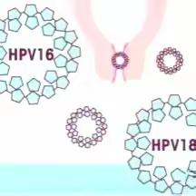 我国首个宫颈癌筛查专家共识发布，主推HPV核酸初筛，我院在行动